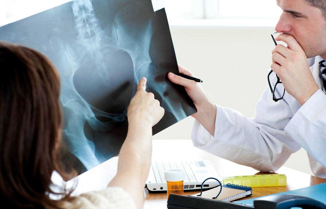 gydytojai tiria rentgeno spindulius dėl klubo sąnario artrozės